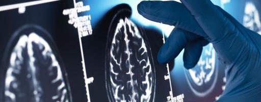 human brain scan