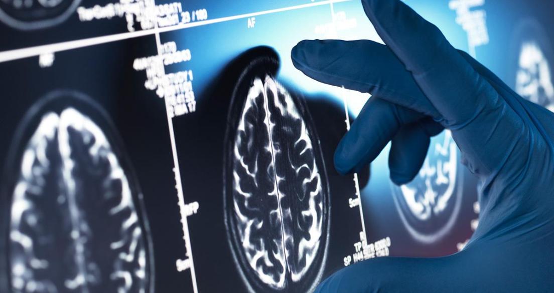 human brain scan